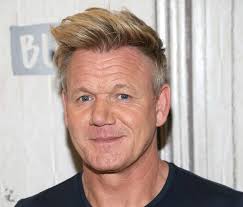 Celebrity Hair Transplants Joe Swash Wayne Rooney Louis Walsh More Hair Loss Medication Hair Loss Cure Losing Hair Women