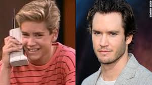 Maybe you would like to learn more about one of these? Mark Paul Gosselaar Plastic Surgery