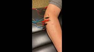 Apexnetwork Physical Therapy Home Facebook