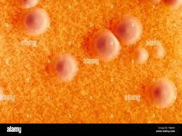 Image result for Corynebacterium