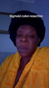 Guía sobre la resección del colon sigmoide