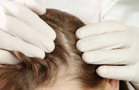 10 Questions to Ask Your Hair Loss Doctor Before Starting Treatment