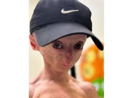 Ron Zachary "Zach" Pickard Obituary (2024)