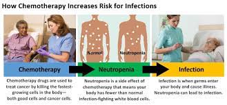 Cost Of Cancer Related Neutropenia Or Fever Hospitalizations Cdc