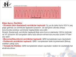 Hasarı önlemek için elimizdeki süre çok kısıtlı olduğundan erken defibrilasyon oldukça etkili ve hayat kurtarıcı bir yöntemdir. Ppt Kardiyak Acillere Yaklasim Powerpoint Presentation Free Download Id 4835592