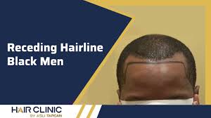 Get it cut short on the top, but leave it long enough so that you can comb a part on the side of your head. Receding Hairline Black Men Hairclinic By Asli Tarcan Hair Transplant