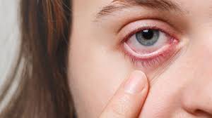 Nose and jaw to stop it. Does Black Fungus Affect Your Eyesight Here Is What We Know