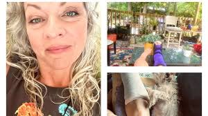 Fundraiser by Angela Mackenzie : Help Angela Recover and Rebuild After  Ankle Surgery