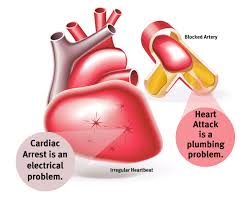 Heart muscle will die if there. The Difference Between Heart Attack And Cardiac Arrest Luminis Health