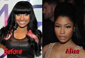 Nicki Minaj Plastic Surgery Before And After3 Nicki Minaj Photos Nicki Minaj Plastic Surgery