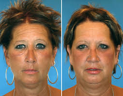 Twins Timothy and Lydia Ridgeway, born from 30-year-old frozen embryos,  have just turned one