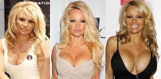 Facelift probably also was taken by loni anderson plastic surgery to keep her face epidermis stronger and eternal. Pamela Anderson Plastic Surgery Before And After Pictures 2021