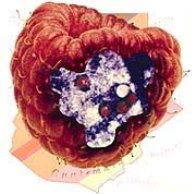 Image result for Cyclospora