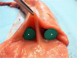 A position or opinion or judgment reached after consideration. An Atypical Presentation Of A Mesenteric Meckel S Diverticulum In A 7 Year Old Warmblood Mare Case Report Bmc Veterinary Research Full Text