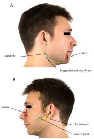 Assessment of axonal excitability properties in two branches of the human  facial nerve