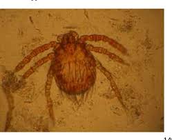 Image result for Trombicula autumnalis