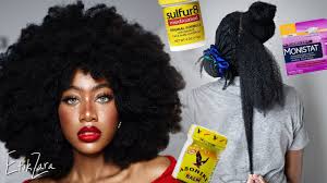 At first i was using monistat but it was expensive so i just used the generic one from walmart, i would rub it on all the thin areas at the top of my head and all over my edges like 3 times a week. Insane Hair Growth Grease Mix It Really Works Black Hair Omg