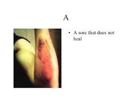 Some warning signs of cancer are below: Caution 7 Warning Signs That You Should Have Examined By A Doctor Ppt Download