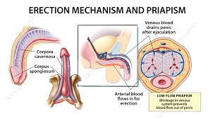 Image result for Priapism
