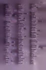 Image result for Schlechterina mitostemmatoides