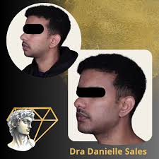 Dra Danielle Sales l Harmonização Facial Definitiva (@dentistabrasilia) •  Instagram photos and videos