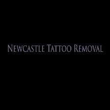 Your trusted tattoo removal clinic in newcastle laser tattoo removal is a safe and effective way of permanently removing a tattoo. Newcastle Tattoo Removal