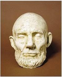 Lincoln may be the first recorded case of rare disease