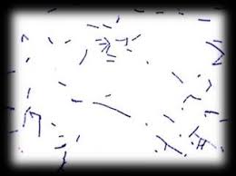 Learn and reinforce your understanding of listeria monocytogenes through video. Morphological Colony And Microscopic Examination Of Listeria Monocytogenes Download Scientific Diagram