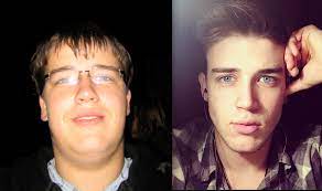 But there are things people can do to get rid of a double chin if it bothers them. How To S Wiki 88 How To Lose Face Fat Reddit