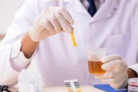 Air seni berwarna kuning pekat bisa jadi gejala penyakit mematikan, ketahui penyebab berbagai kebanyakan orang beranggapan bahwa urine yang berwarna kuning adalah urine yang sehat. 10 Arti Warna Air Urine Terhadap Kesehatanmu Apakah Kamu Cukup Minum