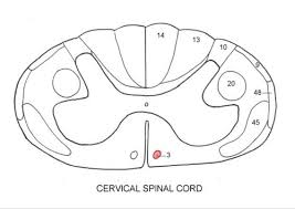 Tethered spinal cord is a condition where the spinal cord is attached to the spinal column and that causes the cord to become stretched. Neurology Ii Spinal Cord Coloring Book Tracts Images Flashcards Quizlet