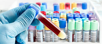 Position： list of companies ›› malaysia ›› allied chemists laboratory sdn bhd. Clinical Laboratory Services Imu Healthcare