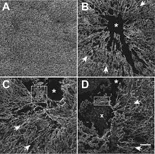 Ultrasound imaging uses sound waves to produce pictures of the inside of the body. Acoustic Modification Of Collagen Hydrogels Facilitates Cellular Remodeling Sciencedirect