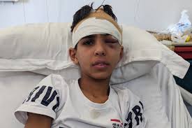 نتیجه جستجوی لغت [injure] در گوگل