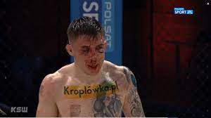 Listen to music from norman parke przed ksw 53 like gamrot w top 10 ufc? Mma Norman Parke Trafil Do Szpitala Po Walce Na Ksw 53 Sport W Interia Pl