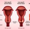 Here you will find one or more explanations in english for the word cervicales. 1