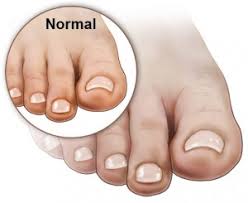 Check spelling or type a new query. Poor Circulation In Feet What You Should Know
