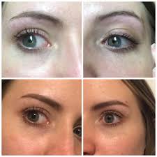A wide variety of eyebrow wax options are available to you, such as form, supply type, and target area. I Got A Really Bad Eyebrow Wax Job The Bottom Pictures Are After I Filled Them In With Makeup I Had To Do This For Months Makeupaddiction