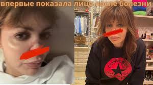 Андрей аршавин и алиса аршавина. Alisa Arshavina Kazmina Vpervye Pokazala Vblizi Izurodovannoe Boleznyu Lico Youtube