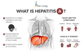 Image result for hepatitis symptoms