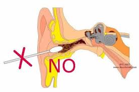 Ear wax, cara membersihkan kotoran telinga yang keras (video 14) cara pekerjaan jasa korek kuping atau membersihkan telinga yang mencurigakan, scam bukan?? Inilah Punca Tahi Telinga Keras Dan Cara Berkesan Bersihkan Lubang Telinga Tersumbat Tanpa Membahayakan Diri Anda Baca Lagi Disini Info Kini Malaysia