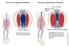Blutgerinnsel In Arm Oder Bein Tiefe Venenthrombose Tvt Deximed Deutsche Experteninformation Medizin