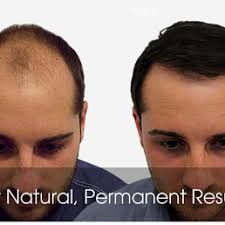 Ziering Medical Reviews