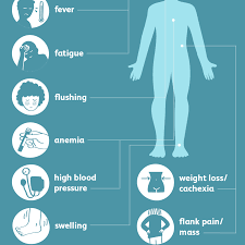 Different diseases may precipitate this side. Kidney Cancer Signs Symptoms And Complications
