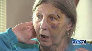80-year-old woman talks about bus attack