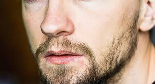 Minoxidil does not work to stop the production of dht. Le Minoxidil Un Produit Pour Faire Pousser La Barbe Big Blog