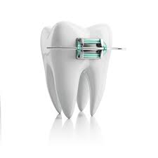 They need adjusted by your orthodontist if they are cutting your gums. How To Handle Pokey Wires And Home And Other Orthodontic Tips Belmar Orthodontics