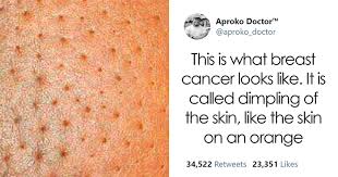 Learn the signs and symptoms of breast cancer and talk to your doctor immediately if you experience any of these signs. Breast Cancer Bored Panda