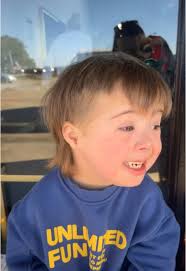 Mullet Shake Down Syndrom