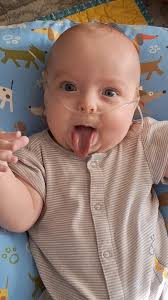 Daniel Carpenter's health progress with gtube and therapies